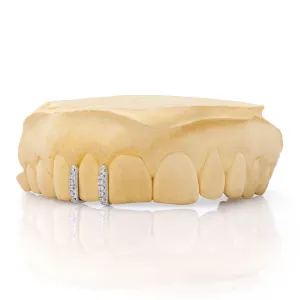 Diamond Spacers Grillz