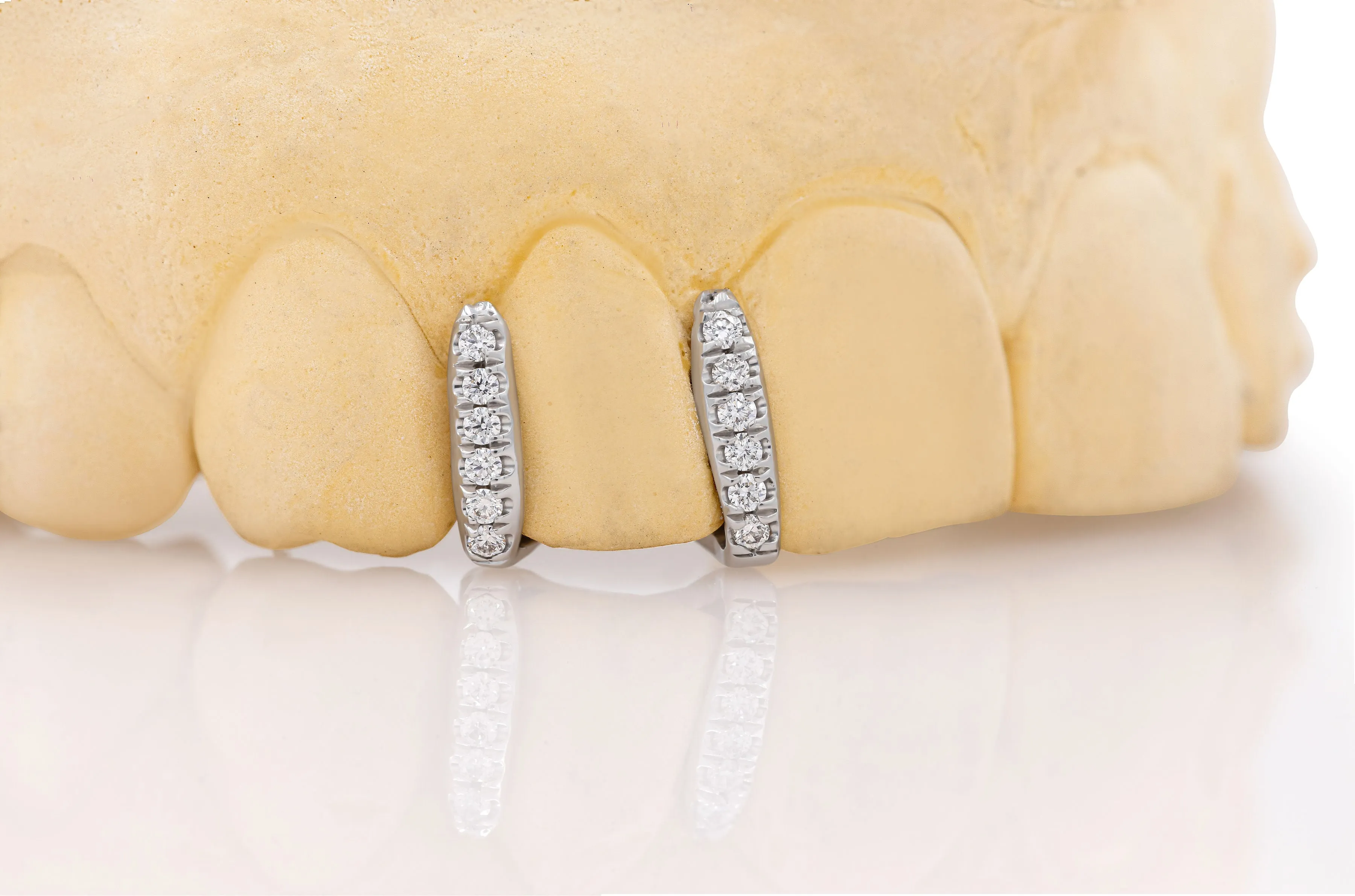 Diamond Spacers Grillz