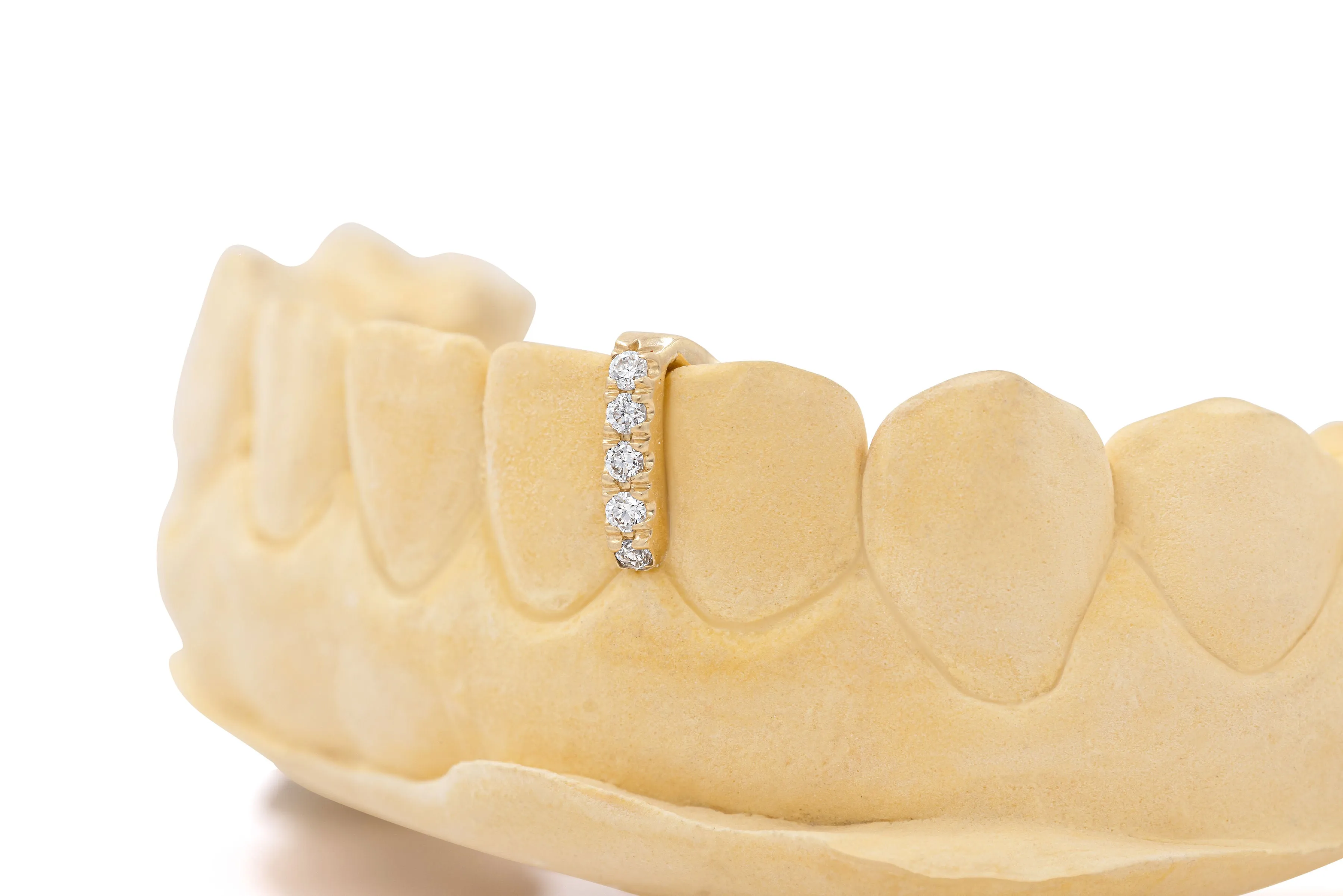 Diamond Spacers Grillz