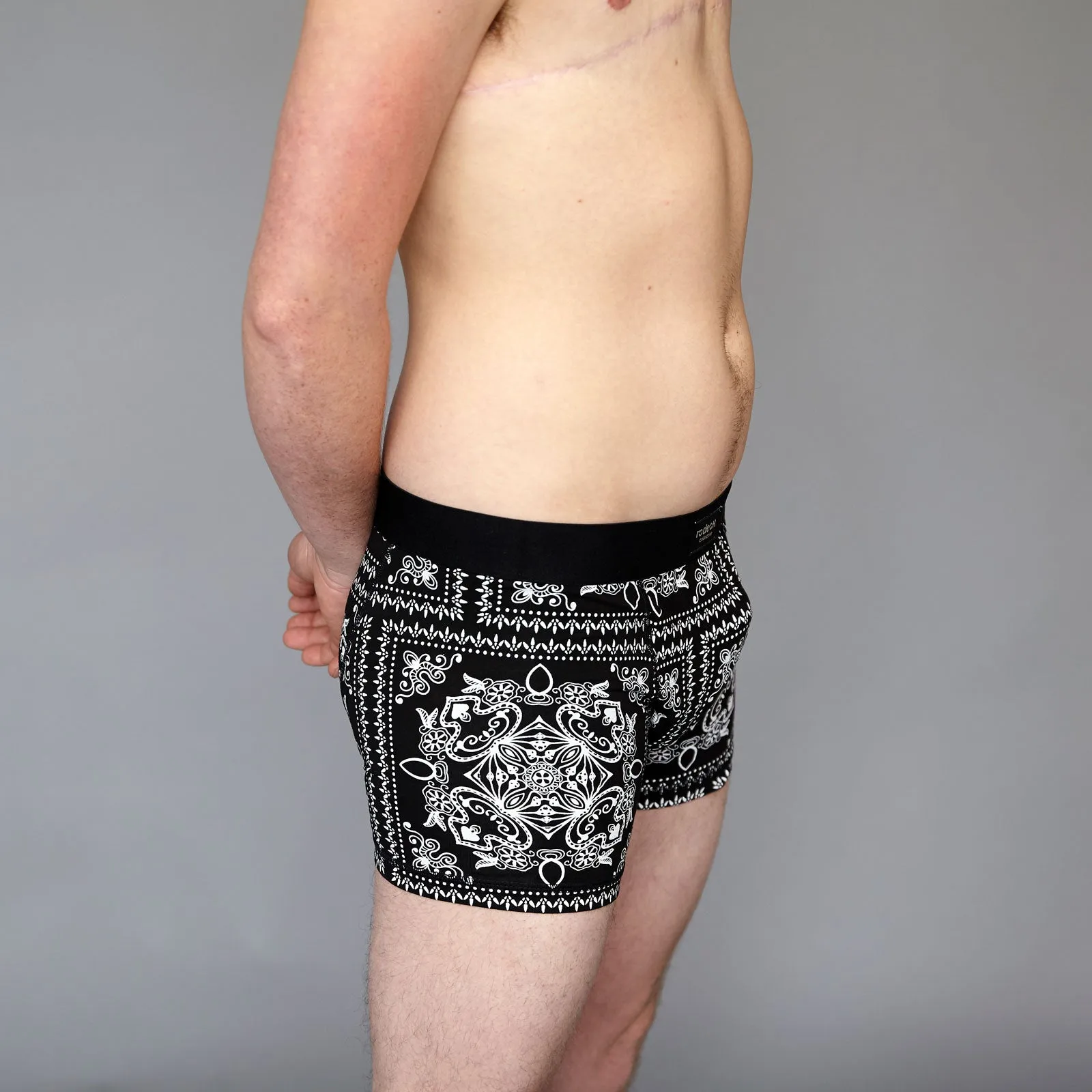 FTM STP - Compact