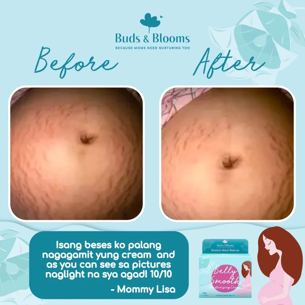 Tiny Buds & Blooms Belly Smooth Stretch Mark Cream 50g