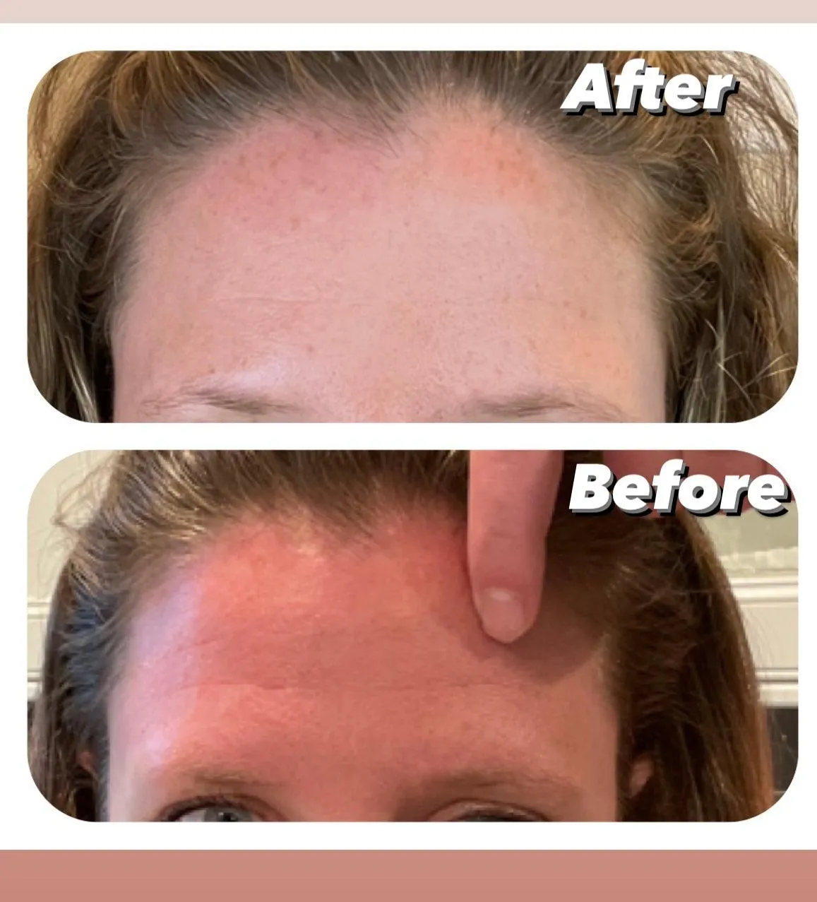 Ultra Anti-Aging Cream active potent non-neutralized glycolic acid (AHA)